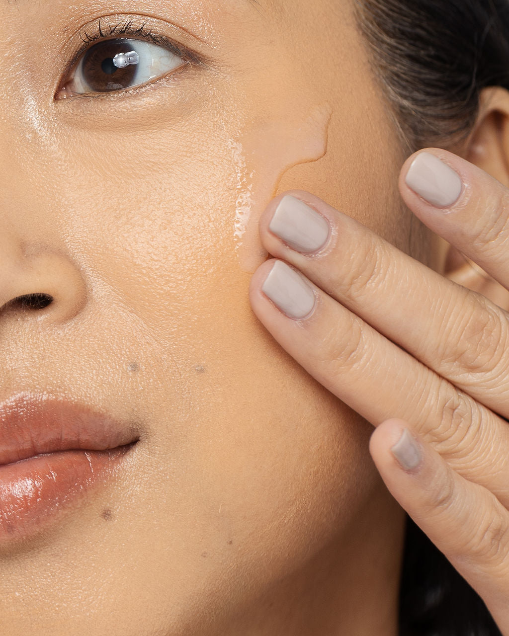 Close-up of a person applying acne treatment lotion to their cheek for clear skin care routine.