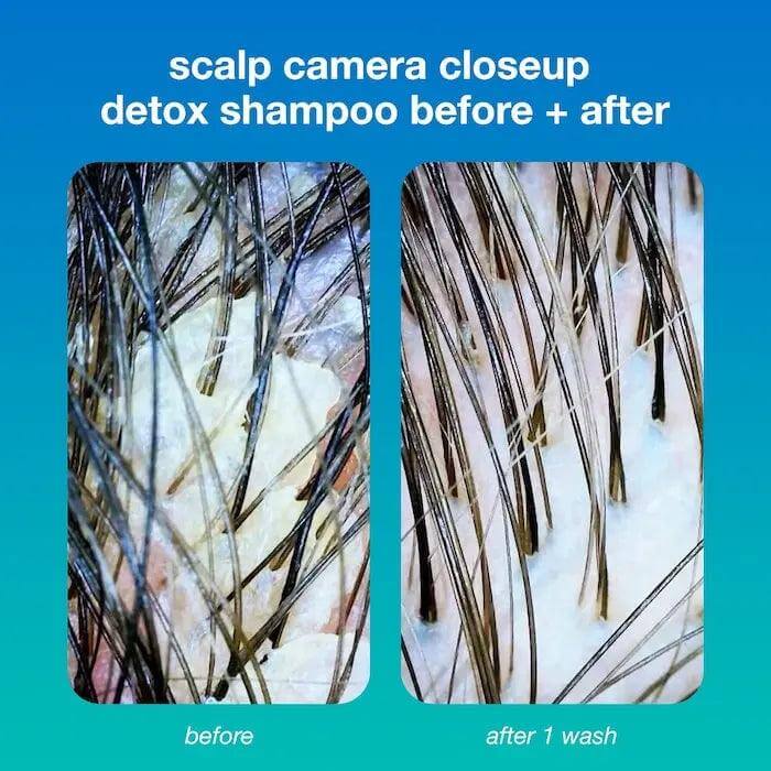 Close-up comparison of hair before and after using detox shampoo, showing reduced buildup and cleaner scalp after one wash.