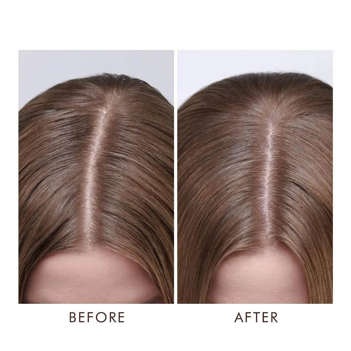 Before and after comparison showing the effects of Moroccanoil Dry-No-More Scalp Treatment on dry scalp.