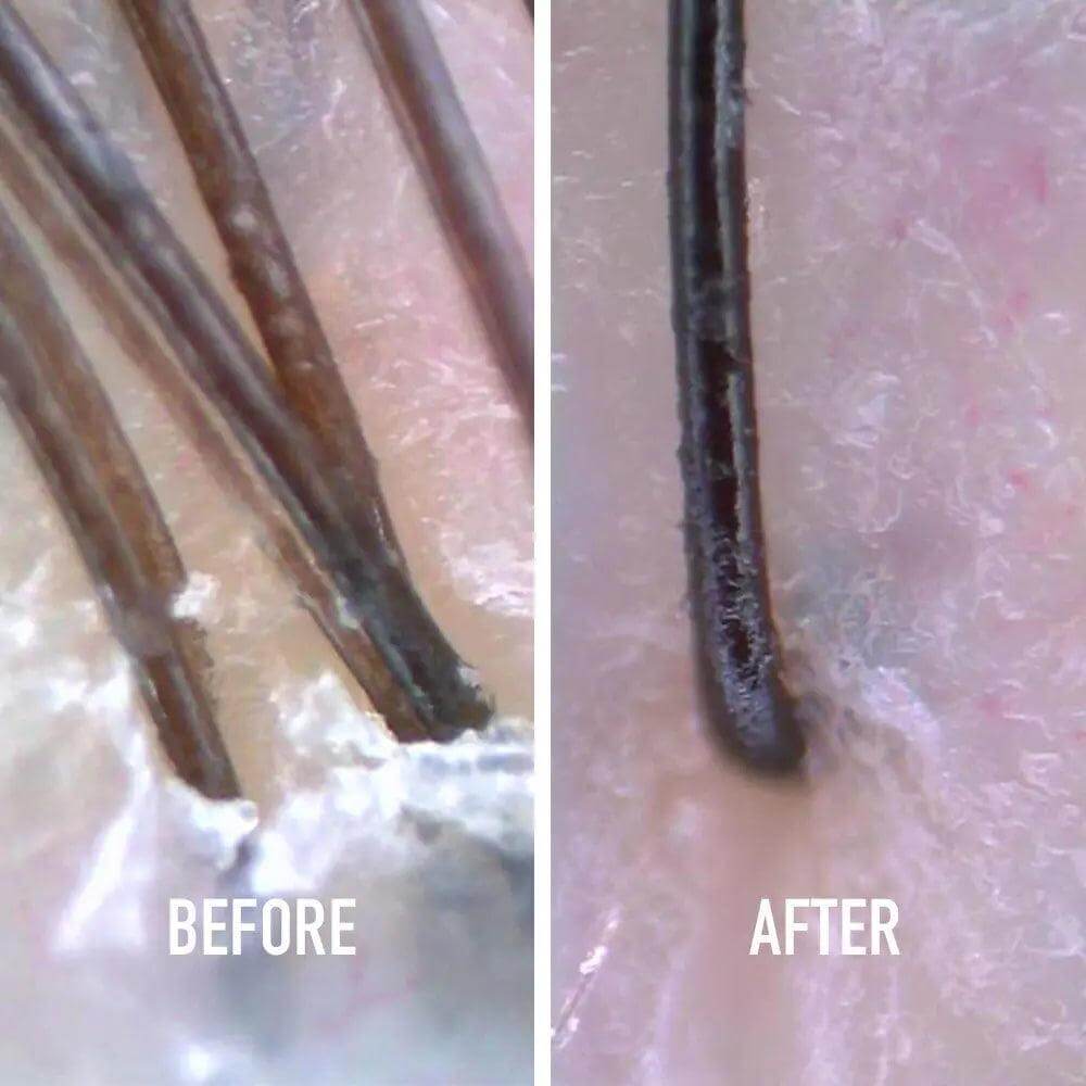 Close-up before and after image showing scalp with buildup versus clean scalp after using Kérastase Fusio Scrub Apaisant.