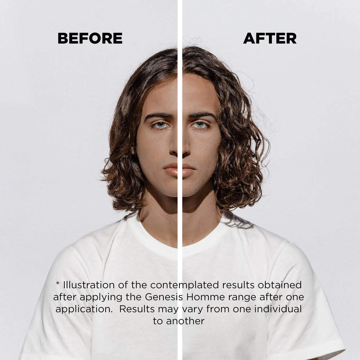 Before and after results of using Genesis Homme Sérum Anti-Chute Fortifiant for hair strengthening and growth in men.