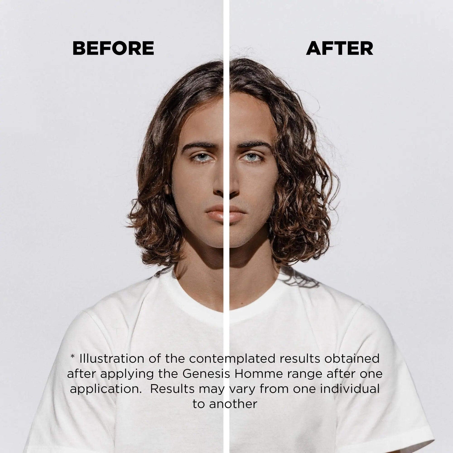 Before and after results of using Genesis Homme Sérum Anti-Chute Fortifiant for hair strengthening and growth in men.