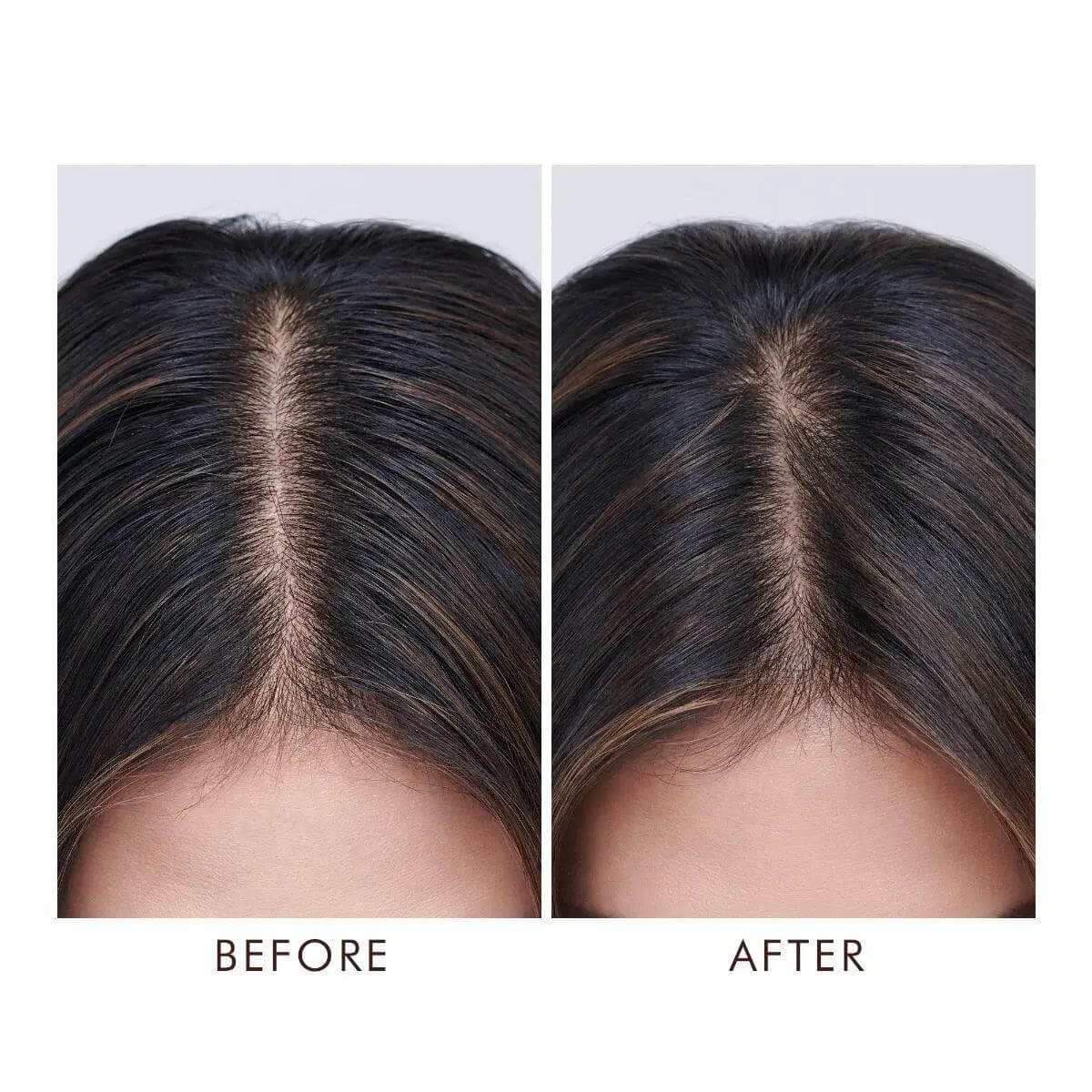 Before and after image showing results of using Moroccanoil Oil-No-More Scalp Treatment for oily scalp control.