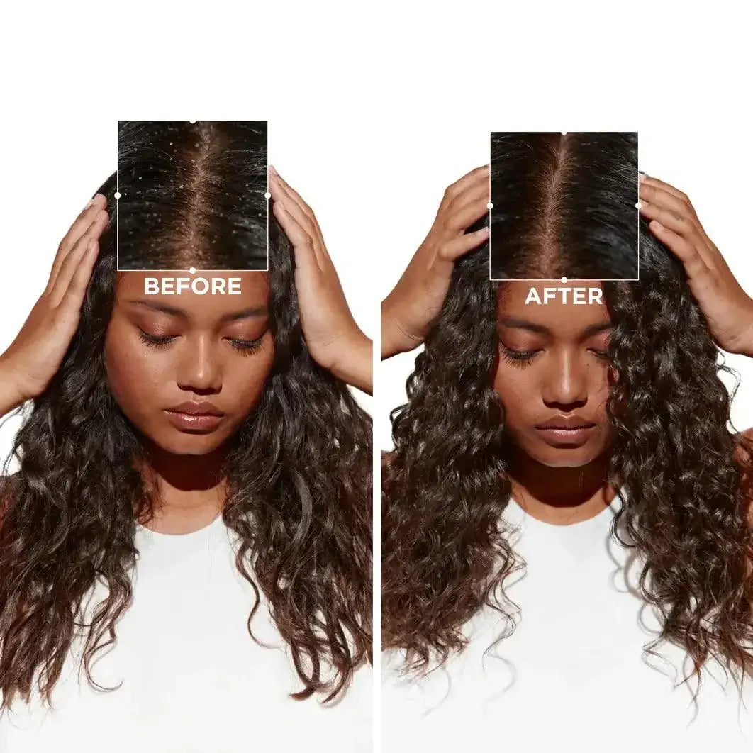 Before and after use of Symbiose Sérum Nuit Intensif by Kerastase, showing revitalized, healthy-looking hair transformation.